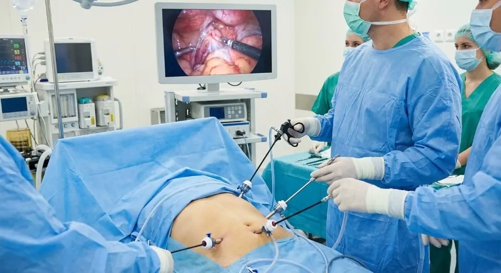 Surgeons Performing Laparoscopic Obesity Surgery with HD Monitor